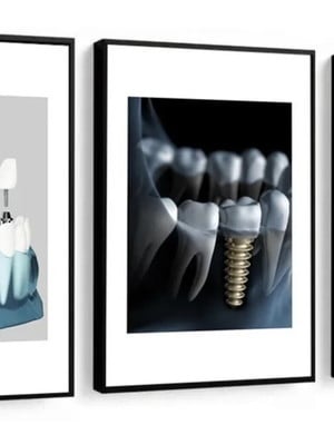Quadro decorativo profissão odontologia dentista consultório