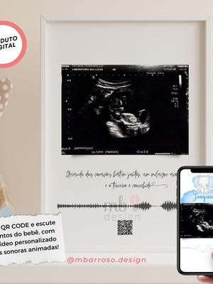 Quadro ultrassom bebê com qr code para os batimentos