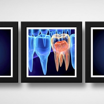 Kit 3 Quadros Endodontia Consultório Dentista Clínica Decor