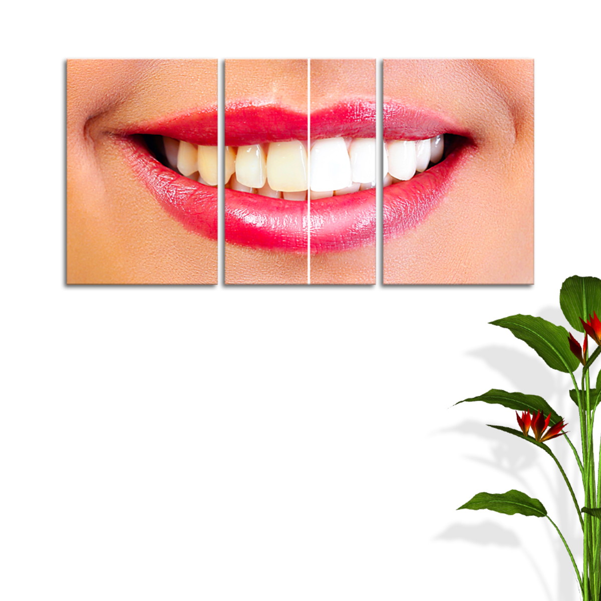 Dental clareamento