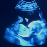 Denis Santos Ferrarezi