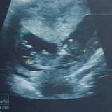 Alice Ribeiro De Almeida