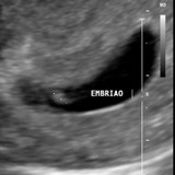 THAIS BRASILEIRO BORGES BELO